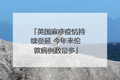 英国麻疹疫情持续蔓延 今年来伦敦病例数最多